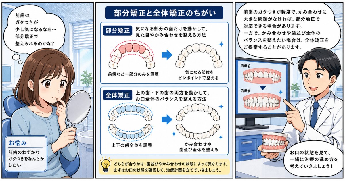 前歯の部分矯正に適応する基準は？全体矯正が必要なケースも解説