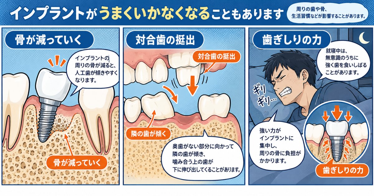 骨吸収が進むリスクとインプラント脱落後の口腔トラブル