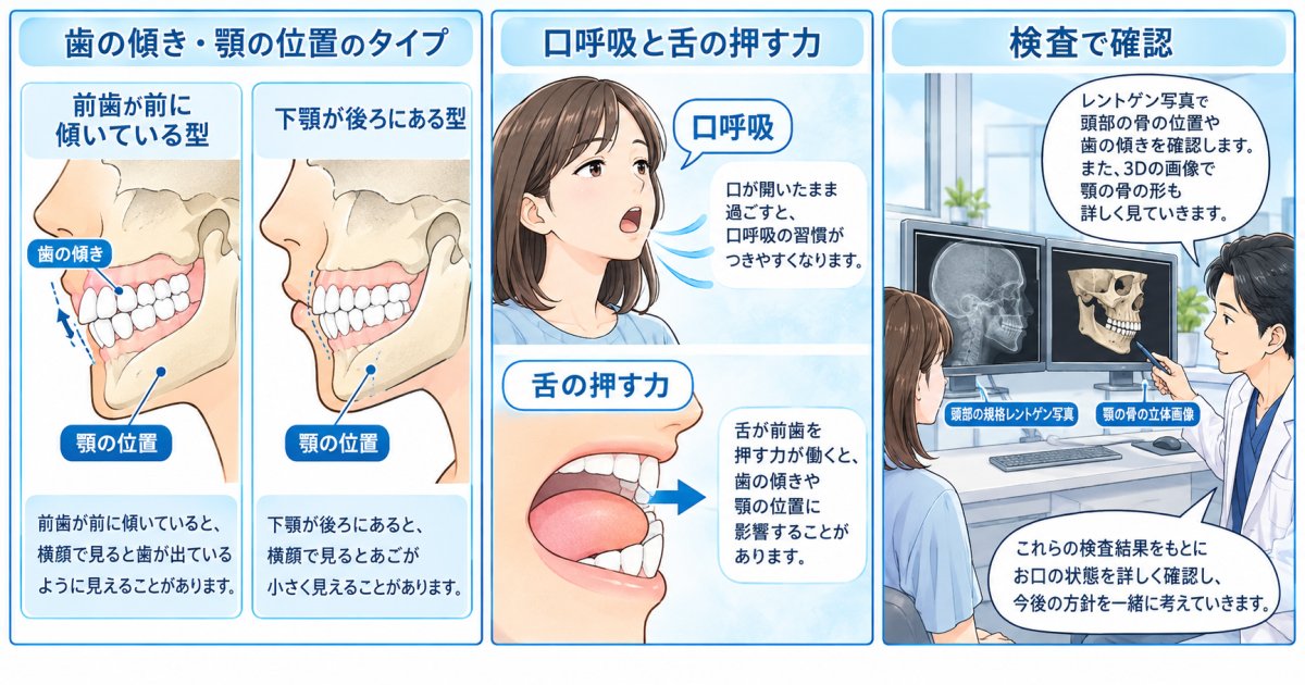 大人の出っ歯は、前歯の傾きだけで判断できる?