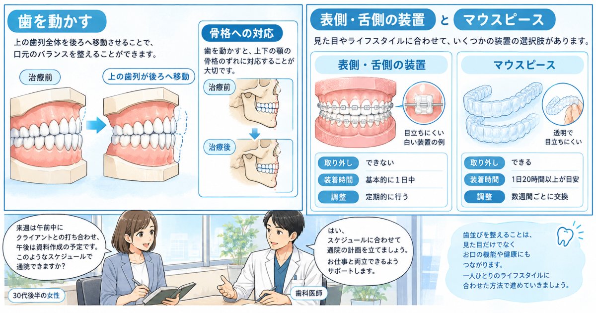 出っ歯の矯正方法は、何を動かすかで変わる